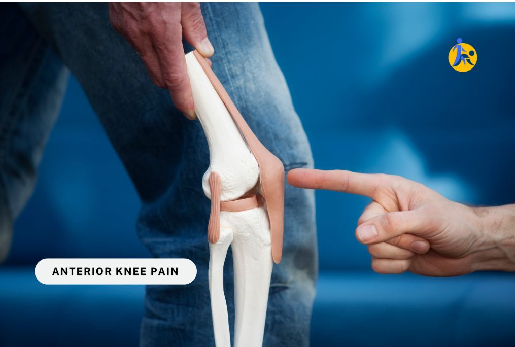 Anterior Knee Pain